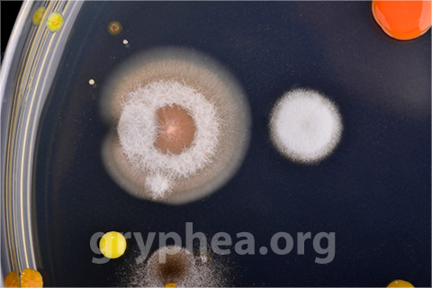 ZN 28482 Colonies microbiennes (bactéries et moisissures diverses)