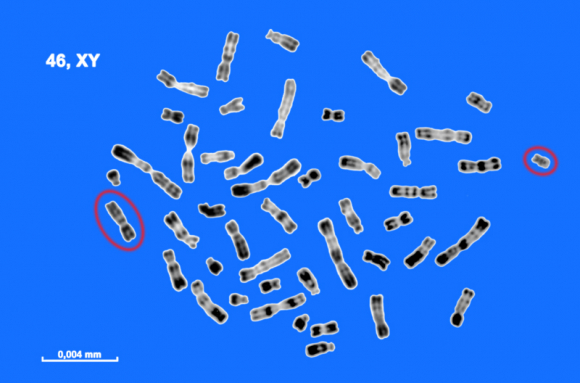 Chromosomes